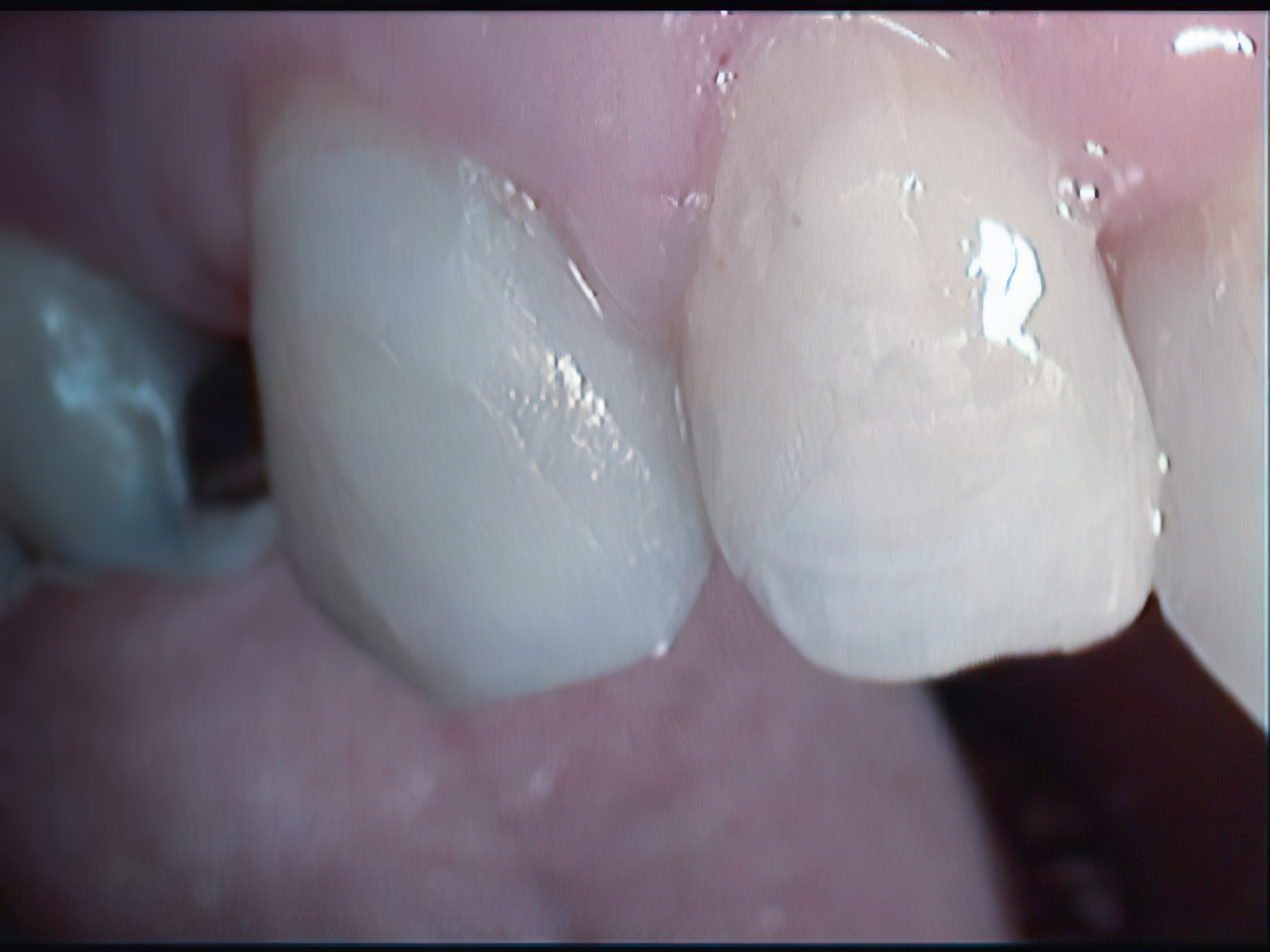 After image
