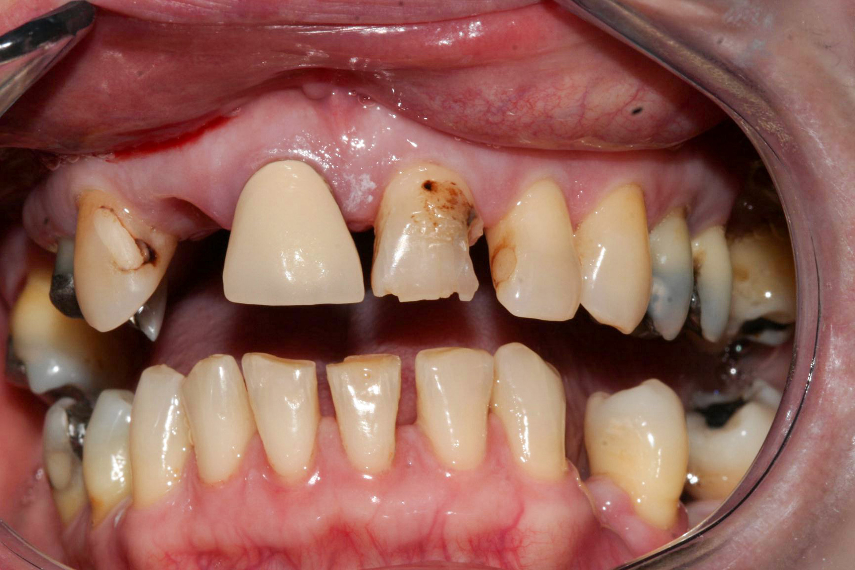 Before image