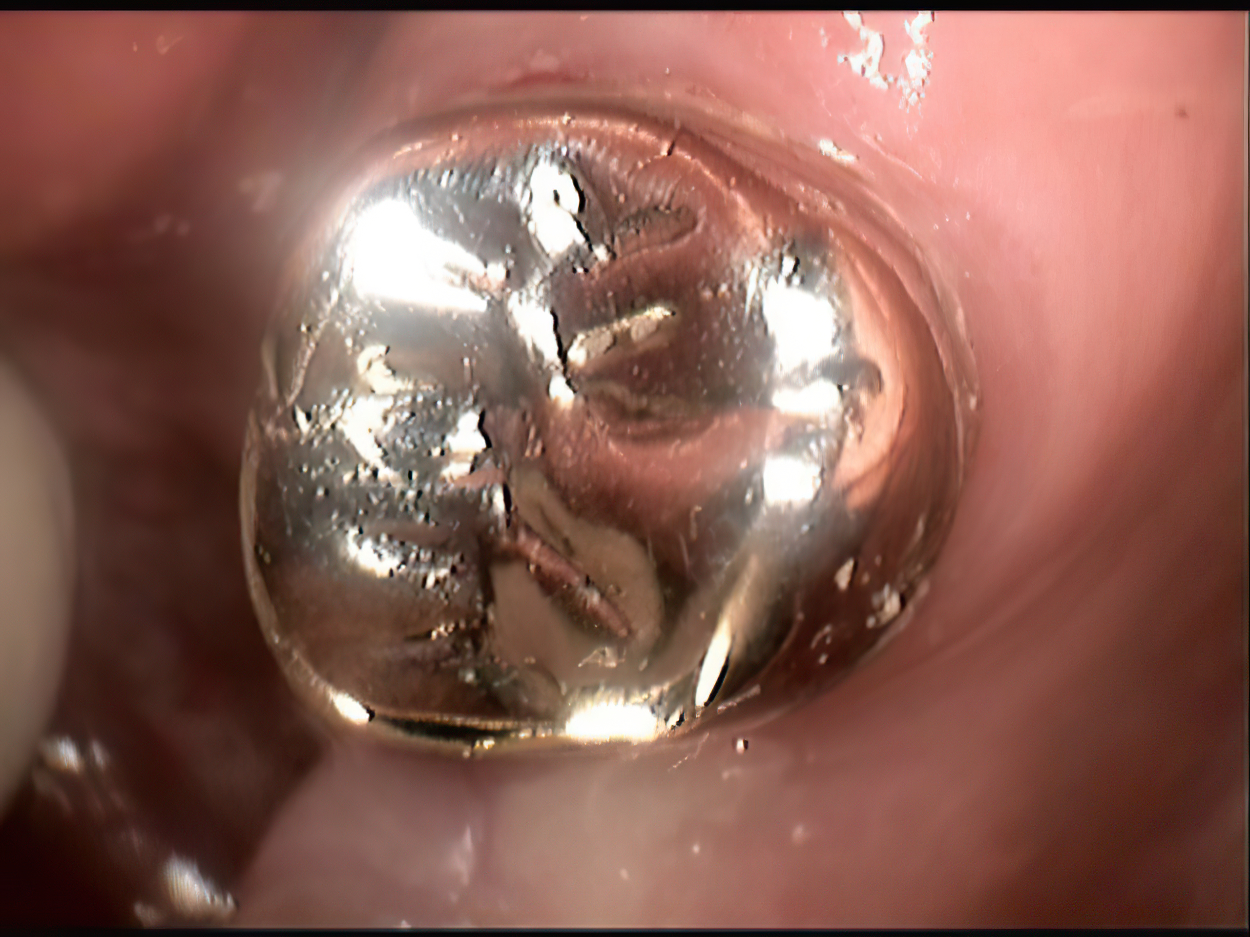 After image