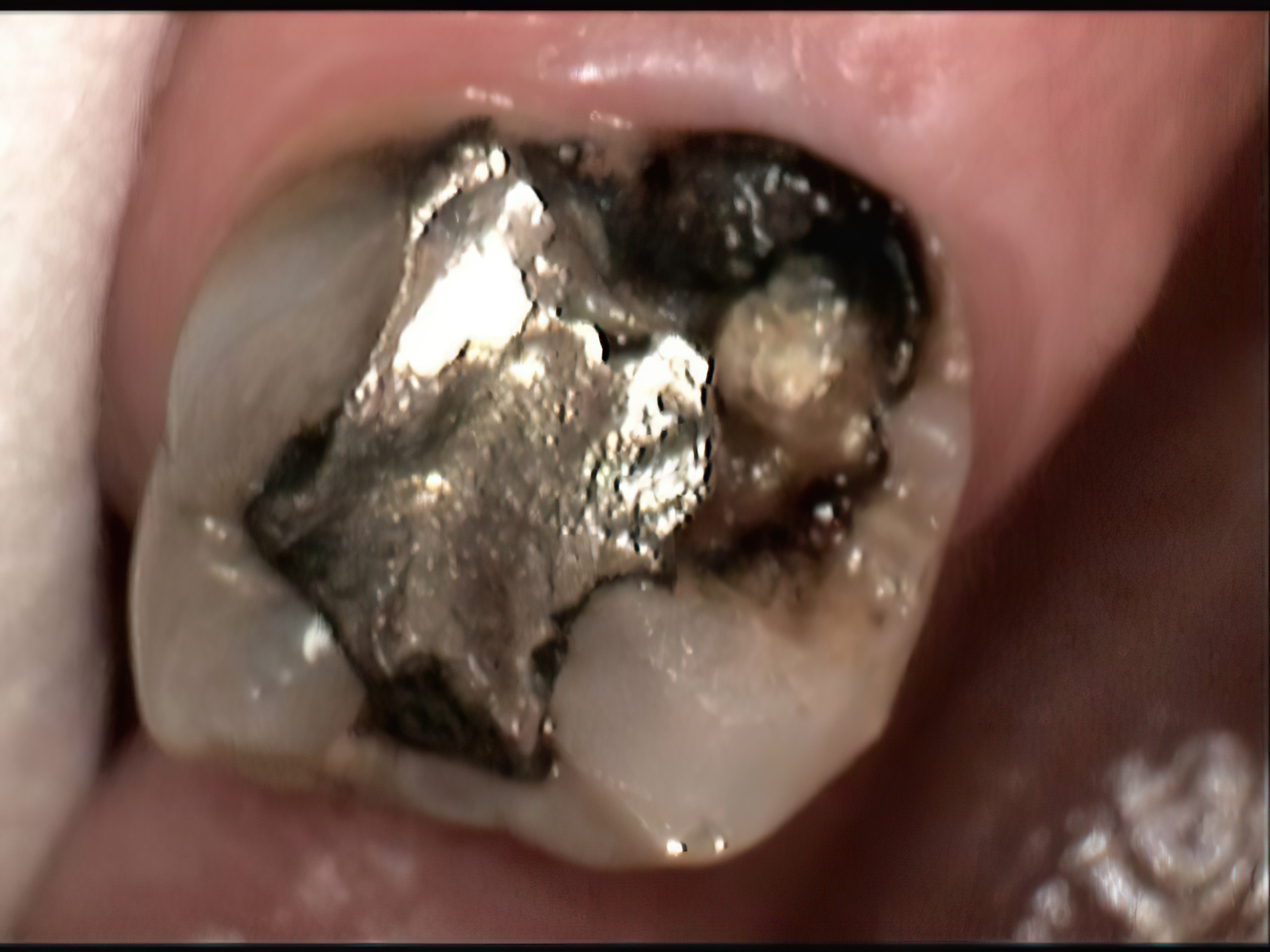 Before image
