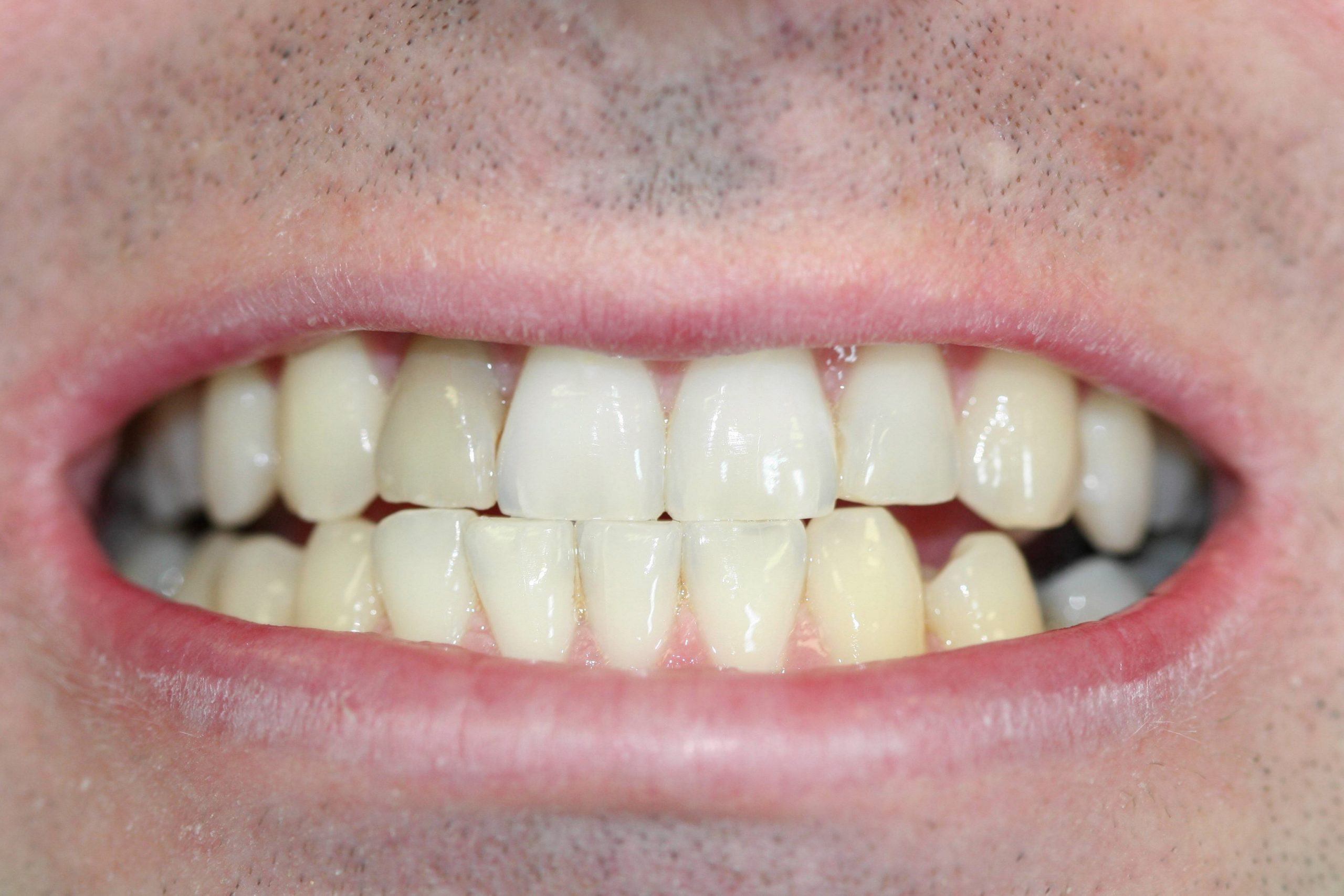 Before image